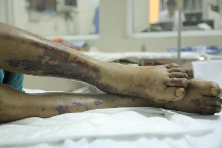 Hiểm họa tiềm tàng từ món ăn lấy may ngày Tết - 4