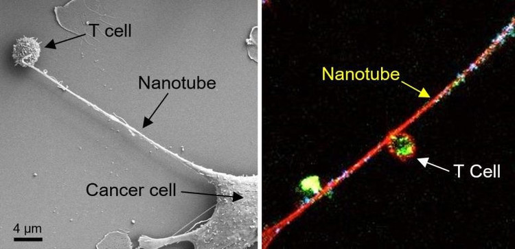 nanotube-between-breast-cancer-cell-and-immune-cell-777x376.jpg