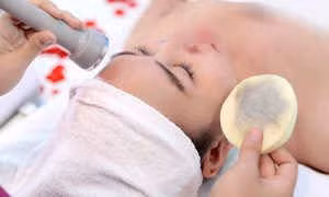 Sự thật về liệu pháp hút chì, thải độc trên da mặt ảnh 1