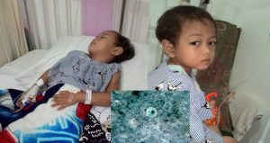 Em bé bị vi khuẩn ăn thủng ruột vì… uống nước bể bơi ảnh 1