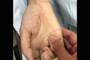 Bị chó ốm cắn vào tay, nữ bác sĩ thú y trẻ tuổi tử vong vì bệnh dại ảnh 1