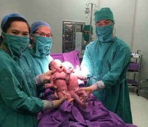 Sinh đôi cùng trứng ra đời nhờ thụ tinh ống nghiệm ảnh 1