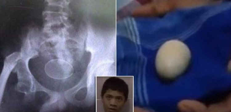 cậu bé biết đẻ trứng 1