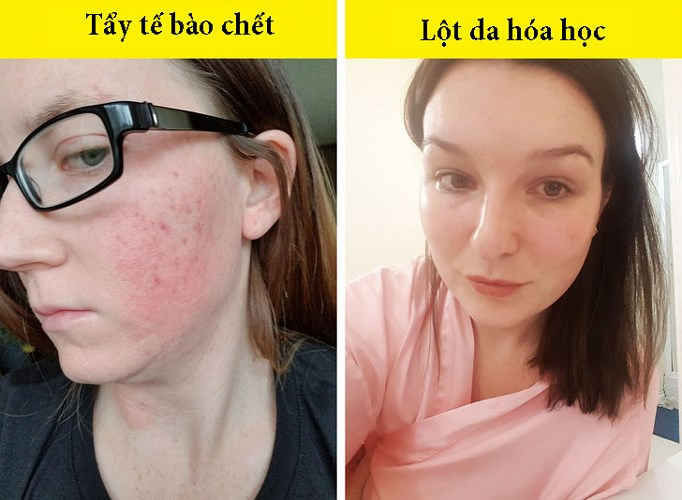 10 sai lam dang huy hoai lan da mat ma ban khong ngo toi hinh 2