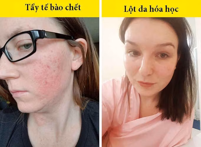 10 sai lầm đang hủy hoại làn da mặt mà bạn không ngờ tới hình 2 10 sai lam dang huy hoai lan da mat ma ban khong ngo toi hinh 2