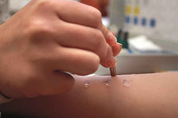 Dị ứng penicillin ảnh 1