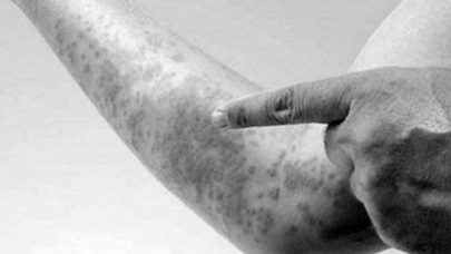 Uống thuốc bổ bừa bãi có thể 