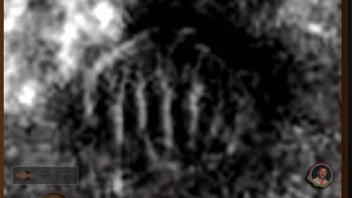 cấu trúc kỳ lạ