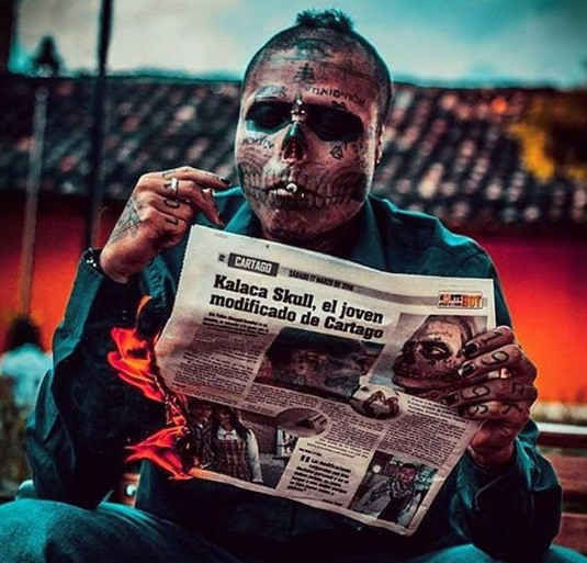 phẫu thuật mặt thành đầu lâu 2