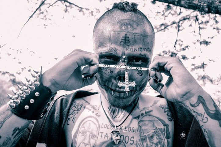 phẫu thuật mặt thành đầu lâu