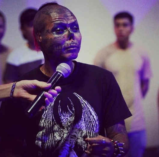 phẫu thuật mặt thành đầu lâu 1