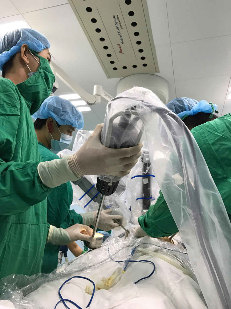 Các bác sĩ Bệnh viện Bình Dân TPHCM đang phẫu thuật robot