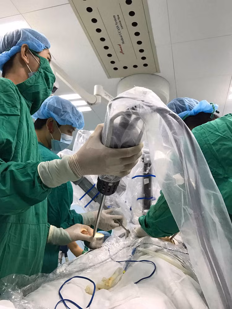 Các bác sĩ Bệnh viện Bình Dân TPHCM đang phẫu thuật robot