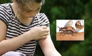 Làm dịu vết côn trùng đốt