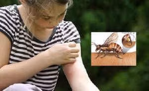 Làm dịu vết côn trùng đốt