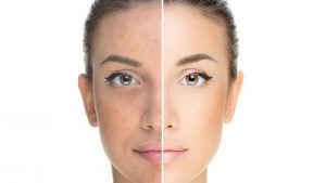 Lợi và hại của làm trắng da ảnh 2