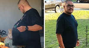 Ung thư tế bào mỡ: Những người có lớp mỡ bụng dày thật sự rất đáng lo ngại! ảnh 3