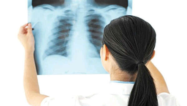 Ho và đờm kéo dài cần được khám bệnh, không nên chủ quan xem thường