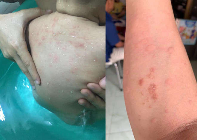 Dan chung cu TP.HCM bat an vi nuoc vang khe, co bo hinh anh 1 