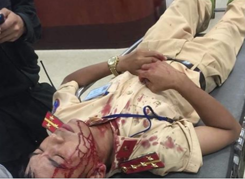 Hà Nội: Đại úy CSGT bị người vi phạm dùng gạch đá tấn công nhập viện cấp cứu ảnh 1