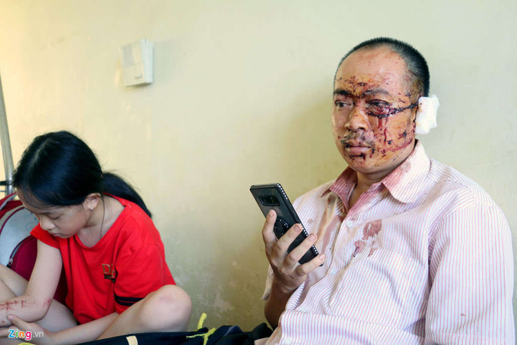 Nan nhan xe Phuong Trang: Nguoi vang khap noi, la het that thanh hinh anh 1 