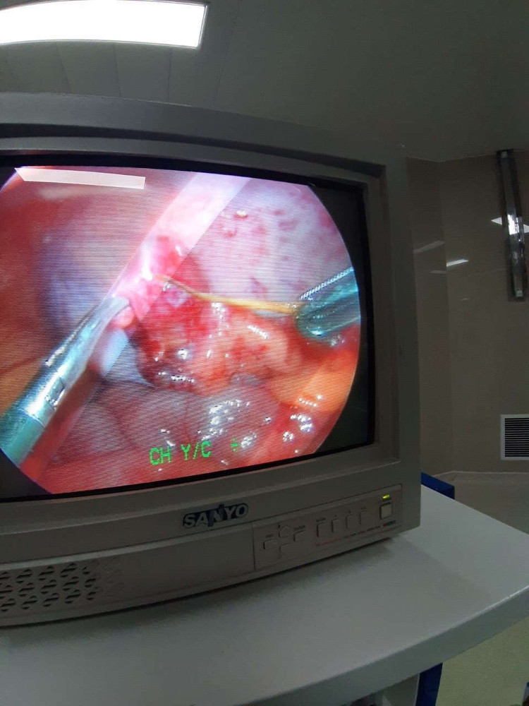 Keyword đầu tiên có dấu