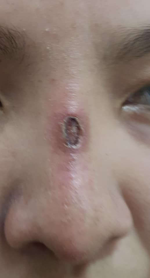 Hoại tử mũi, nát ngực vì làm đẹp đón Tết - ảnh 1