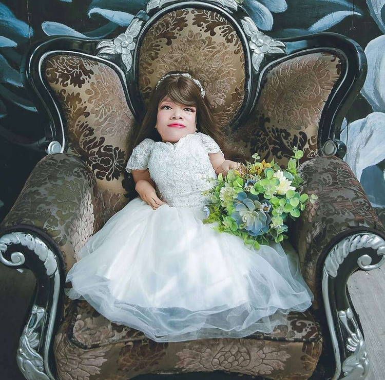 Nỗ lực phi thường của người phụ nữ cao 70 cm