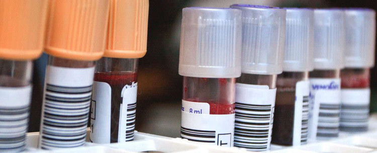 Đã có bệnh nhân HIV thứ 2 trong lịch sử được chữa khỏi, mở ra chương mới cho y học - ảnh 2