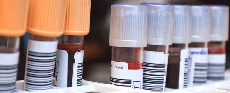 Đã có bệnh nhân HIV thứ 2 trong lịch sử được chữa khỏi, mở ra chương mới cho y học - ảnh 2