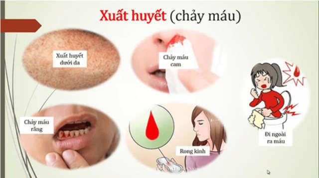 Nguy cơ bùng phát dịch sốt xuất huyết ở Hà Nội - ảnh 1