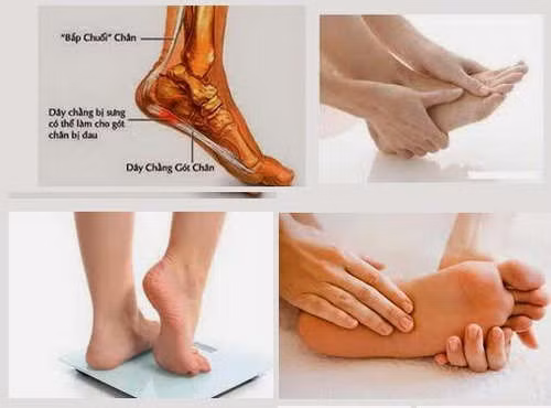 Ngâm chân mỗi tối và xoa bóp khắp các vùng trên của bàn chân để các cơ bắp chân được thư giãn.