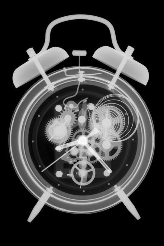 Những giấc mơ tưởng vu vơ nhưng chính là dấu hiệu cảnh báo ít ai biết - ảnh 2