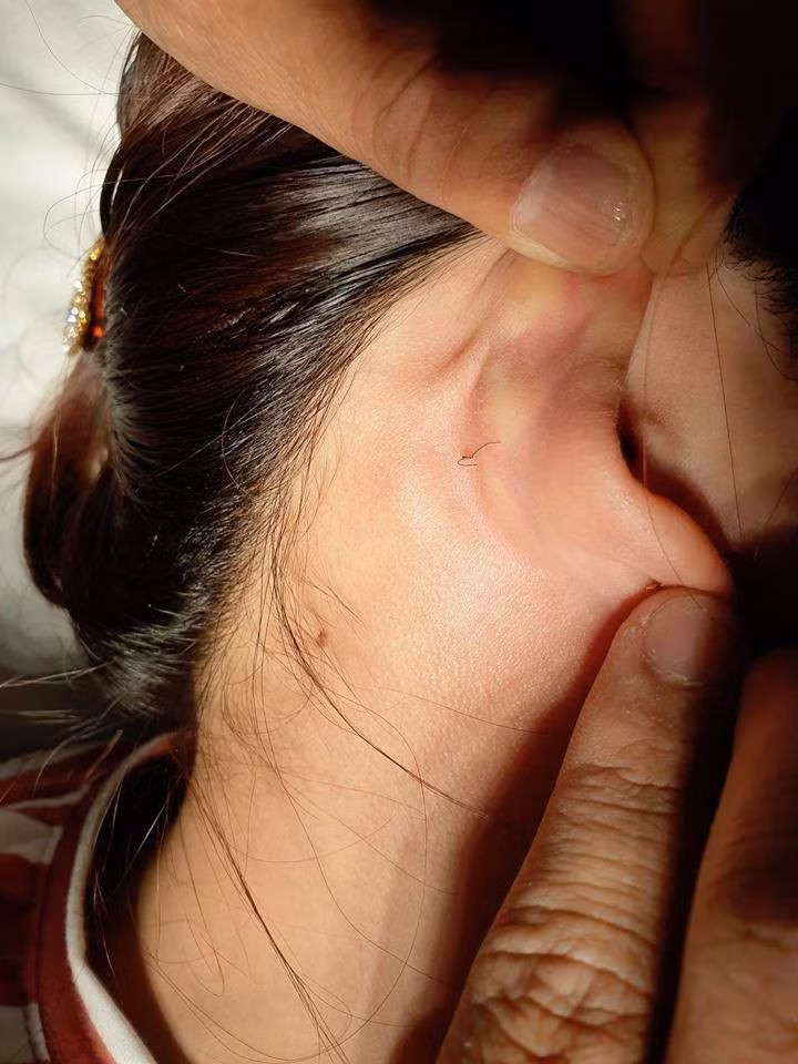 Hoại tử mũi, nát ngực vì làm đẹp đón Tết - ảnh 2