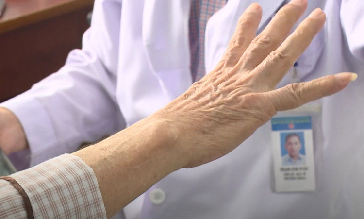 Liệu pháp kích thích não sâu giúp cải thiện chất lượng cuộc sống của bệnh nhân Parkinson.