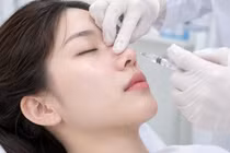 Cảnh báo áp xe, nhiễm trùng muộn sau tiêm chất làm đầy không rõ nguồn gốc