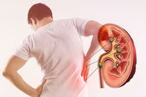 Người trẻ suy thận giai đoạn cuối: Thói quen nào đang hủy hoại thận?