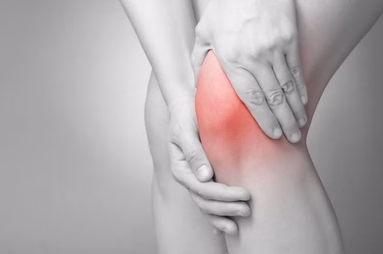 Thoái hóa khớp gối thực chất là tình trạng tổn thương sụn khớp, kèm phản ứng viêm và giảm thiểu lượng dịch khớp do quá trình tái tạo sụn khớp không kịp để bù vào lớp sụn đã mất theo thời gian. Ảnh minh họa Thoái hóa khớp gối thực chất là tình trạng tổn thương sụn khớp, kèm phản ứng viêm và giảm thiểu lượng dịch khớp do quá trình tái tạo sụn khớp không kịp để bù vào lớp sụn đã mất theo thời gian. Ảnh minh họa