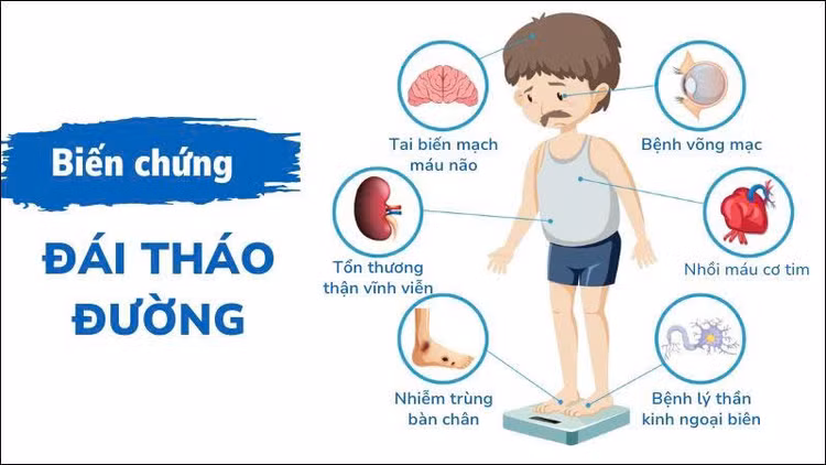 Hình minh hoạ/ Nguồn: internet