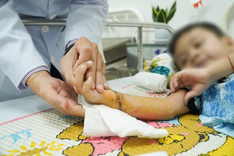 Hiện tại dịch ở vết mổ cẳng bàn tay phải đã khô, bàn tay cũng hồng ấm và các ngón tay đã vận động nhẹ được. Ảnh báo Công an Nhân dân