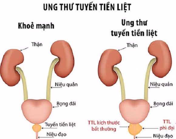 Ảnh minh họa Ảnh minh họa