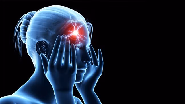 "Điểm mặt" 8 triệu chứng phổ biến cảnh báo nhồi máu não, cần lưu ý. Ảnh minh họa