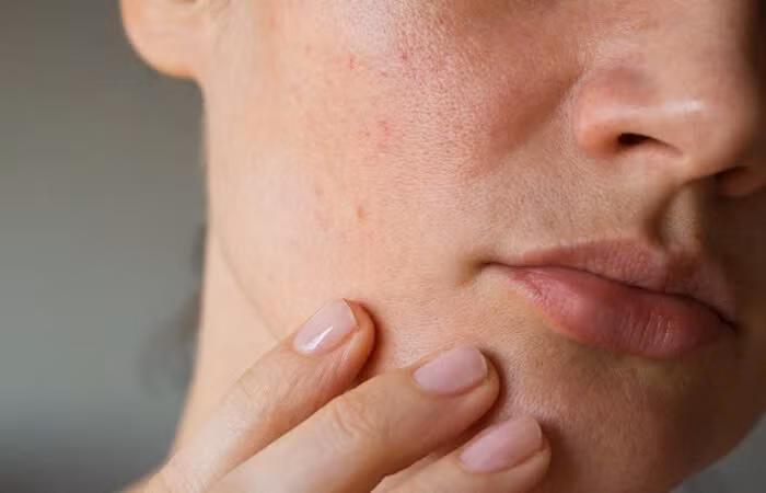 Khi cơ thể bắt đầu già đi, việc sản xuất collagen tự nhiên giảm dần, dẫn đến da khô hơn, xuất hiện nhiều nếp nhăn và các dấu hiệu lão hóa khác. Ảnh minh họa