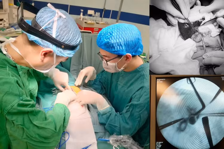 Phẫu thuật điều trị teo mật bẩm sinh cho bệnh nhi. Ảnh BVCC Phẫu thuật điều trị teo mật bẩm sinh cho bệnh nhi. Ảnh BVCC