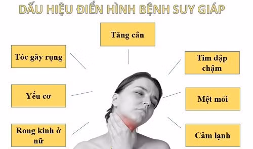 Ảnh minh hoạ Ảnh minh hoạ