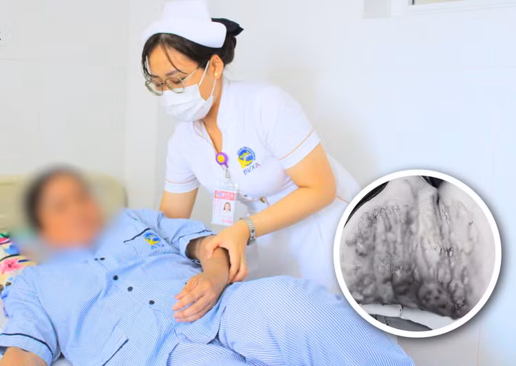 Bệnh nhân được theo dõi tại bệnh viện. Ảnh: BVCC Bệnh nhân được theo dõi tại bệnh viện. Ảnh: BVCC