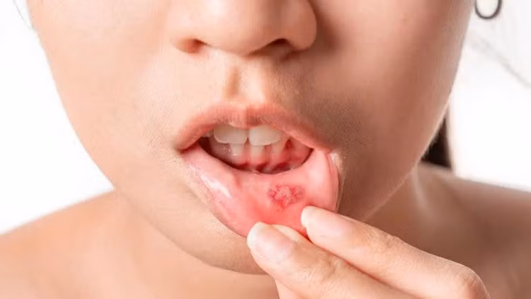 Ảnh minh họa Ảnh minh họa