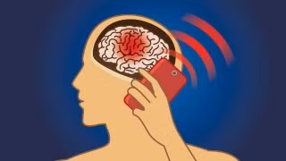 WHO công bố mối liên hệ giữa điện thoại di động và ung thư não. Ảnh minh họa