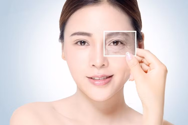 Mặc dù các nếp nhăn dưới mắt dường như là một phần không thể tránh khỏi của quá trình lão hóa, nhưng có một số vài phương pháp có thể hỗ trợ bạn ngăn chặn điều này. Ảnh Internet Mặc dù các nếp nhăn dưới mắt dường như là một phần không thể tránh khỏi của quá trình lão hóa, nhưng có một số vài phương pháp có thể hỗ trợ bạn ngăn chặn điều này. Ảnh Internet