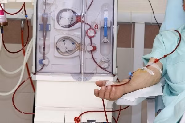 Liên tục chảy máu miệng, ăn kém,... đi khám phát hiện suy thận giai đoạn cuối. Ảnh Minh họa Liên tục chảy máu miệng, ăn kém,... đi khám phát hiện suy thận giai đoạn cuối. Ảnh Minh họa